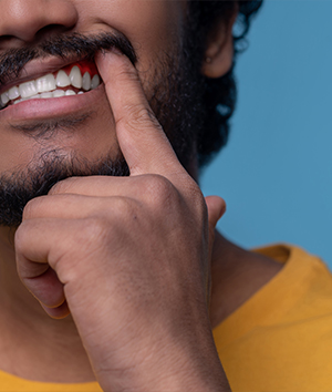 Periodontics (Gum Care)