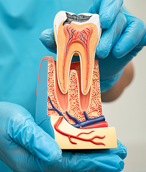 Endodontics (Root Canal Treatment)