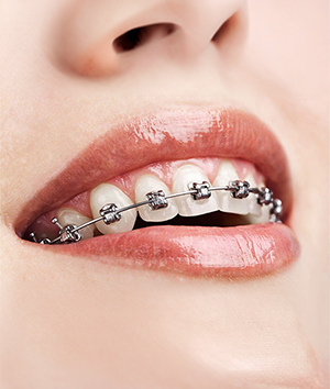 Orthodontics