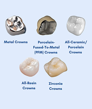 Prosthodontics