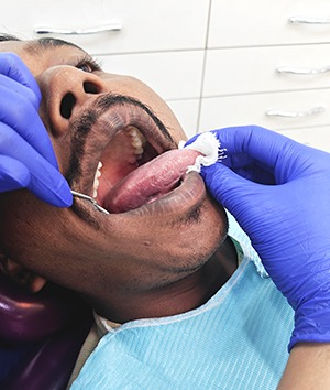 Oral Cancer Screening